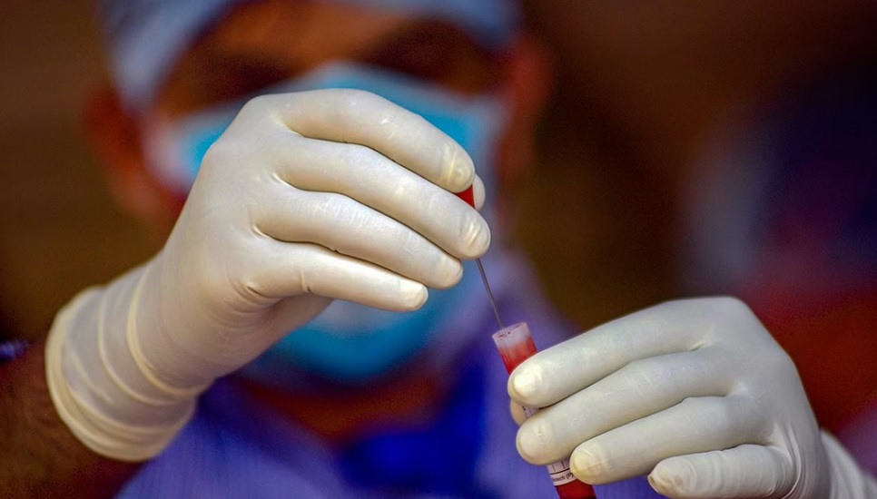 ICMR has trained 15 Virus Research and Diagnostic Laboratories across the country to conduct diagnostic test for Monkeypox. (Representative Image/PTI)