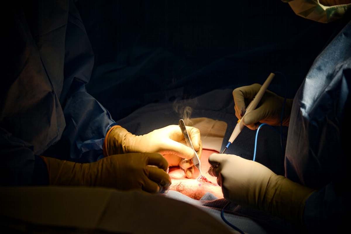 The director added after the surgery four patients complained of acute gastroenteritis and approached private hospitals for treatment. While undergoing treatment, two women died due to complications.