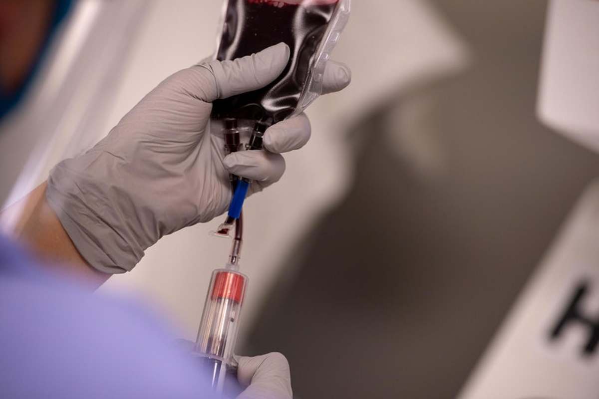 Thalassemia HIV