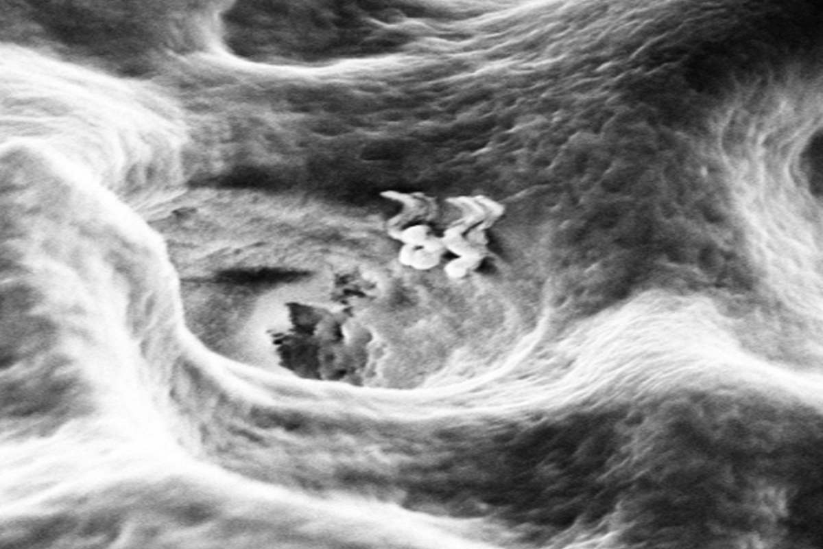 IISc Bengaluru develops nanobots that can enter a dentinal tubule. (Supplied)