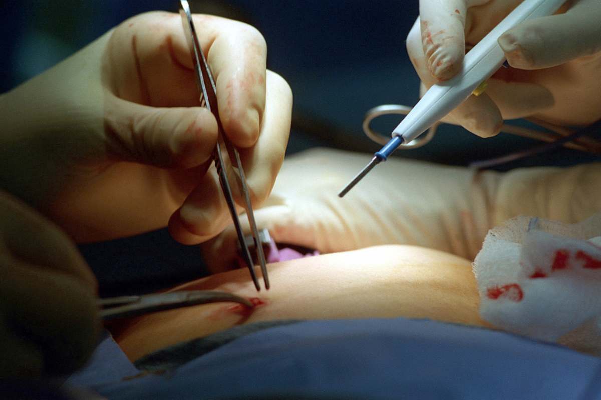 Surgery