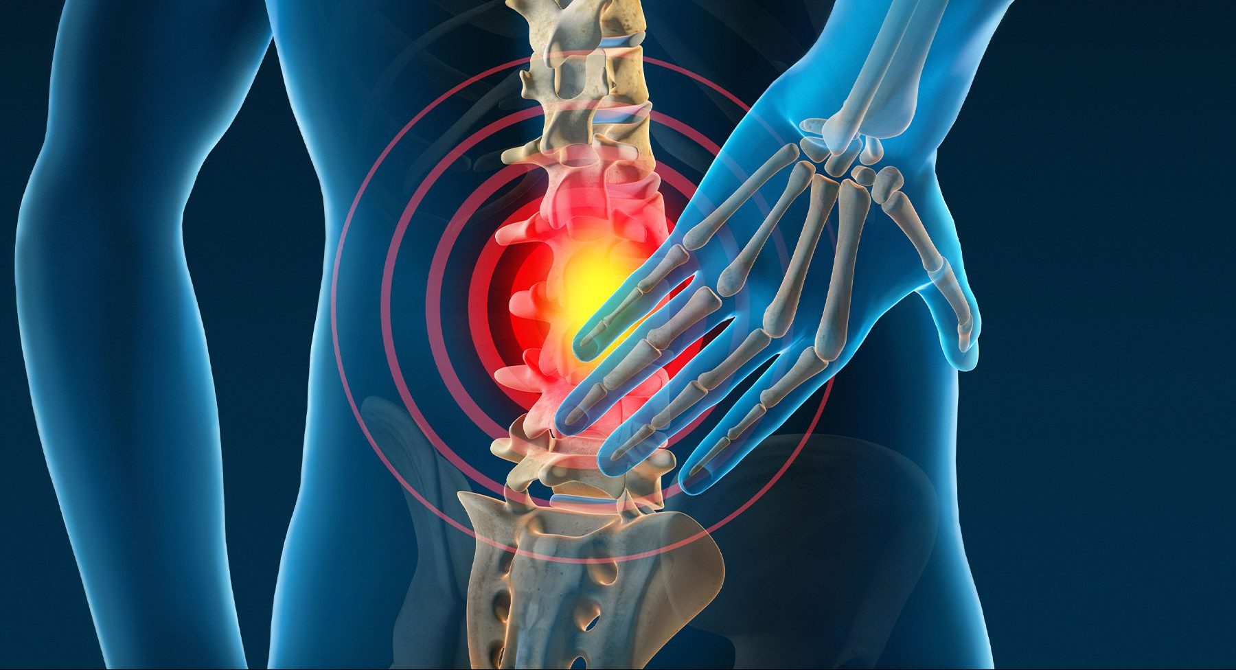 back pain