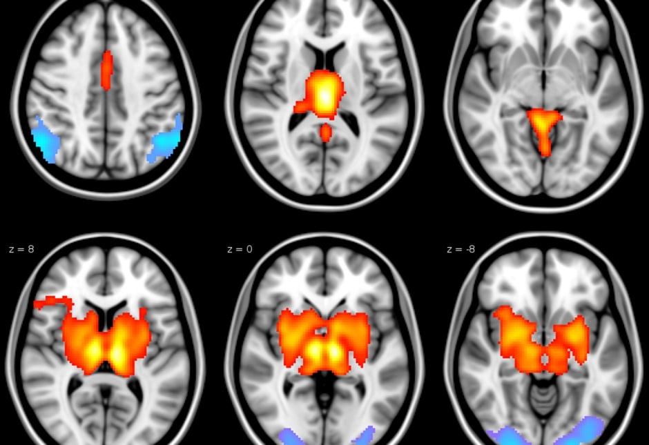 Epilepsy-scan