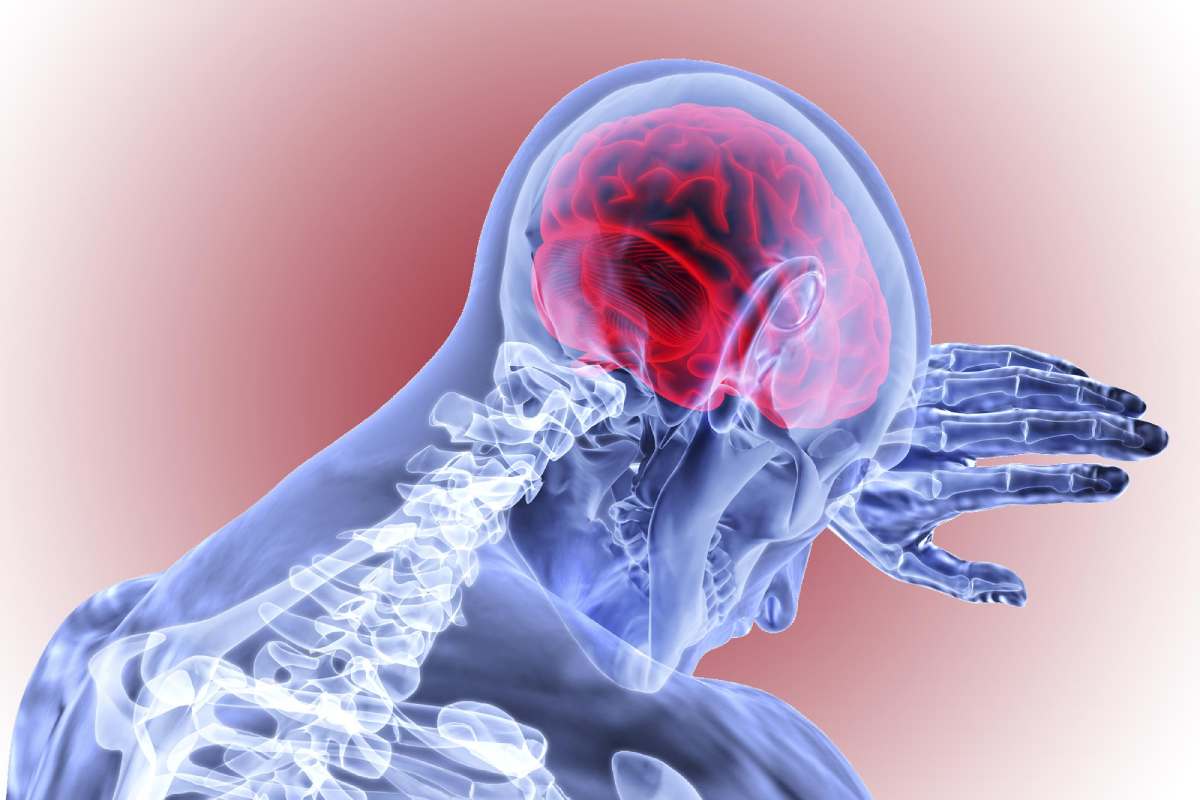 Ischemic stroke