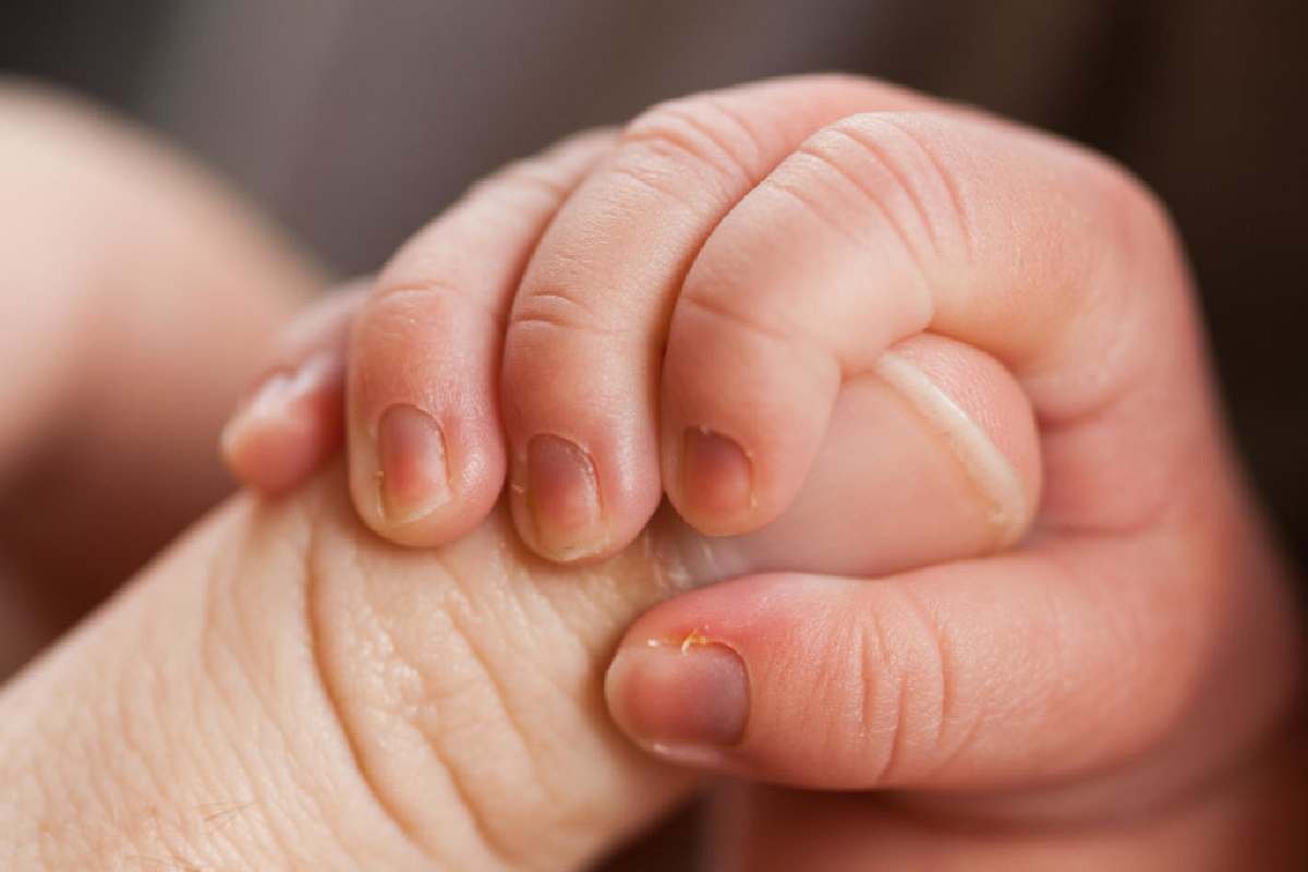 neonatal