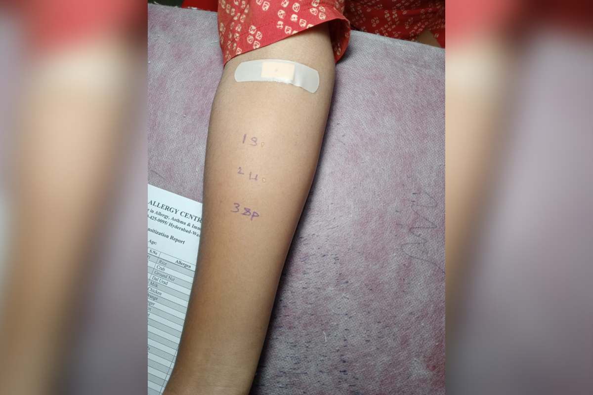Semen Allergy