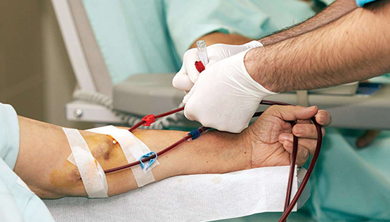Representational pic of a dialysis unit in a government hospital.