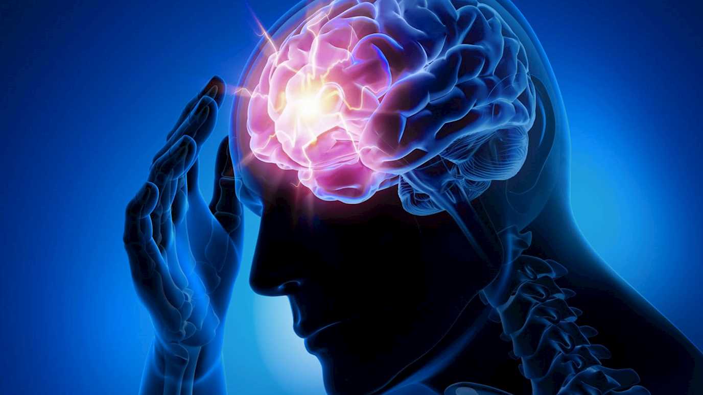 Epilepsy pic