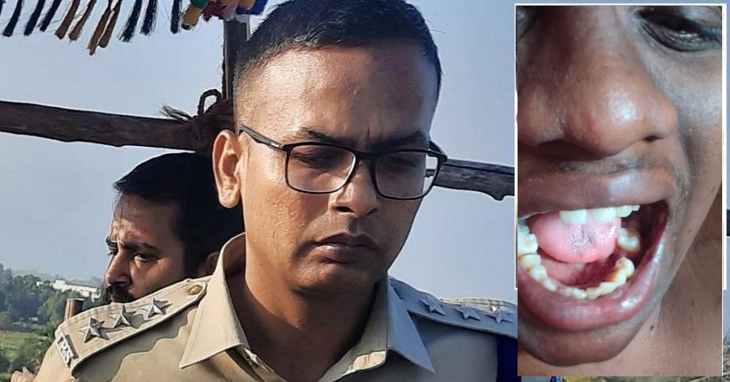 Balveer Singh (left), and one of the victims showing his injury.