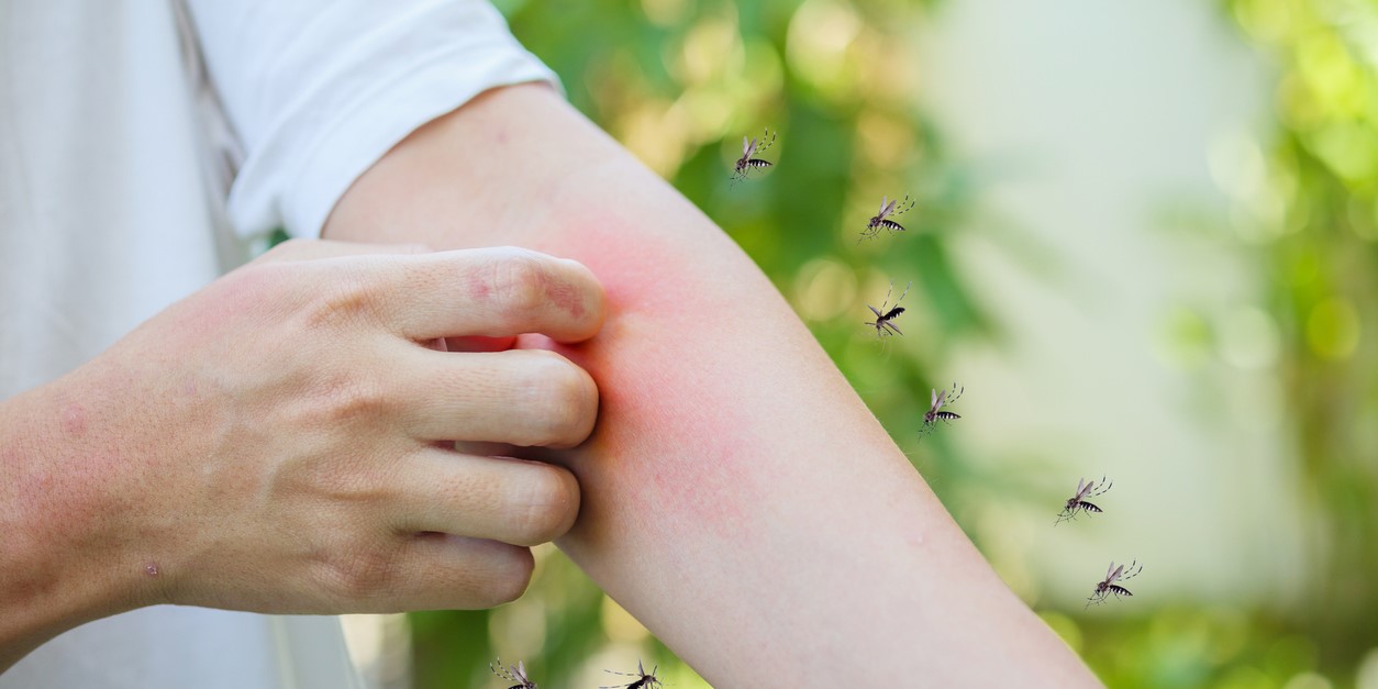 Mosquitoes biting a person. (iStock)