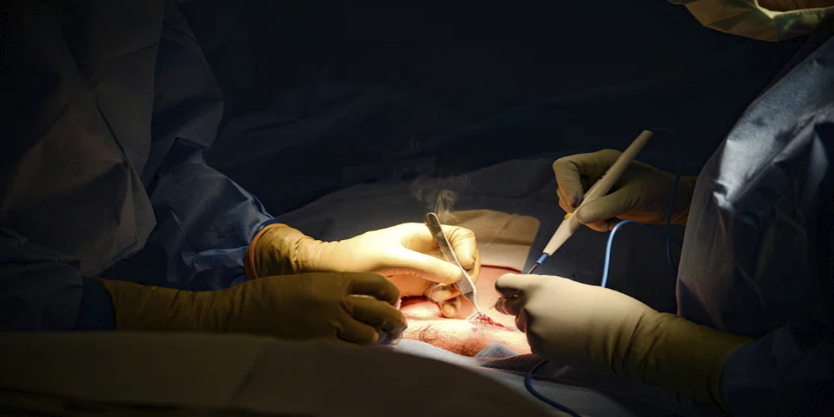 Bengaluru hospital told to pay ₹1.6 crore compensation to family for death of patient during C-section surgery