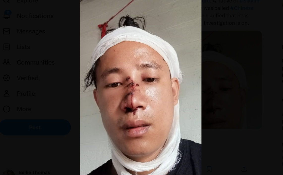 Dinesh Subba, the victim
