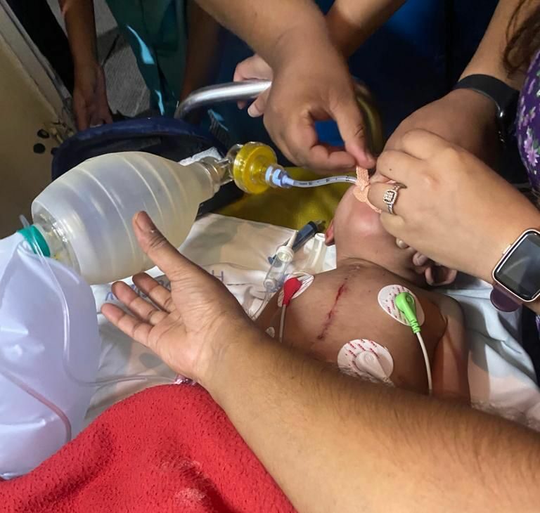 Two year old baby saved mid-air by five AIIMS doctors on board Vistara airlines.