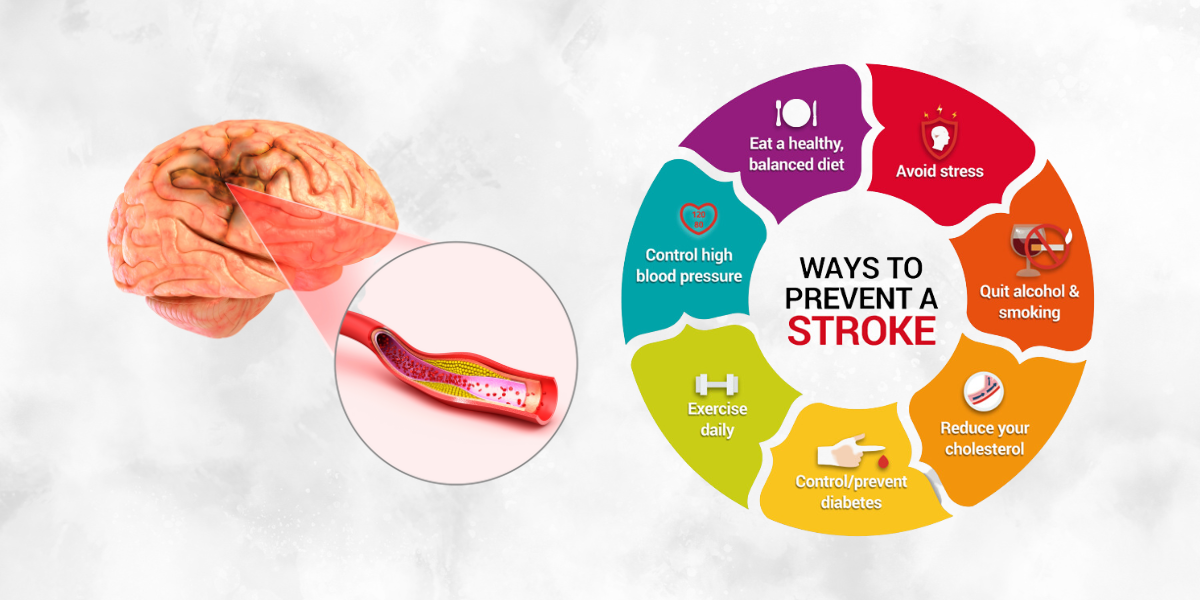 Medication adherence and risk factor monitoring are key aspects of prevention of a new stroke. (Commons/Union Ministry of Health and Family Welfare)
