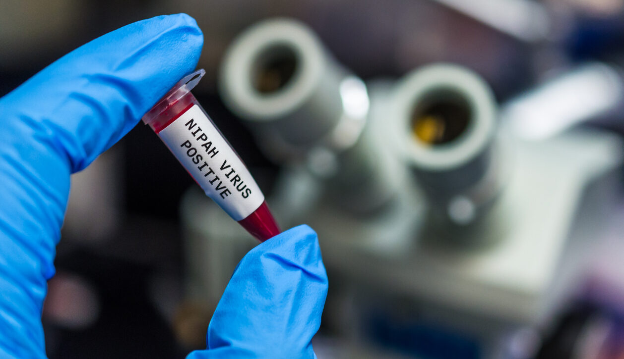 Nipah virus