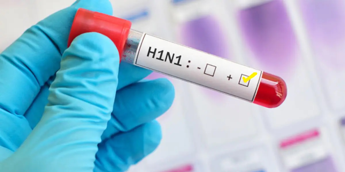 According to the National Centre for Disease Control’s (NCDC) Integrated Disease Surveillance Programme, 893 swine flu cases and 3 deaths were reported in the state between 1 January and 31 July 2023. (Wikimedia Commons)