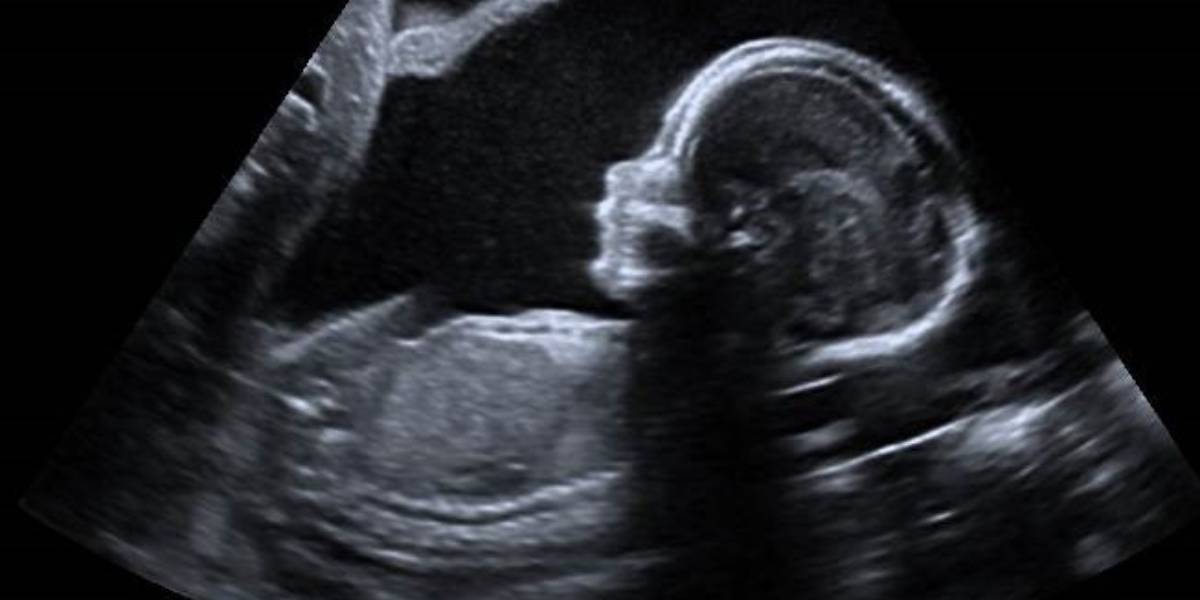 Kerala hospital ordered to cough up ₹50 lakh for failing to detect foetal anomalies during pregnancy