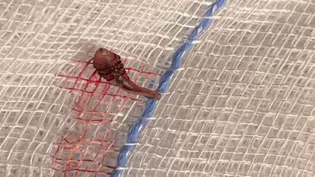 The botfly larva that was removed from the woman's scalp. (Supplied)