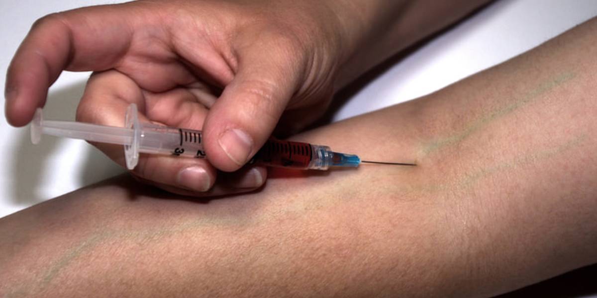 The potency of Fentanyl makes it effective in providing relief from intense pain, but it also increases the risk of overdose if not used properly. (Creative Commons)