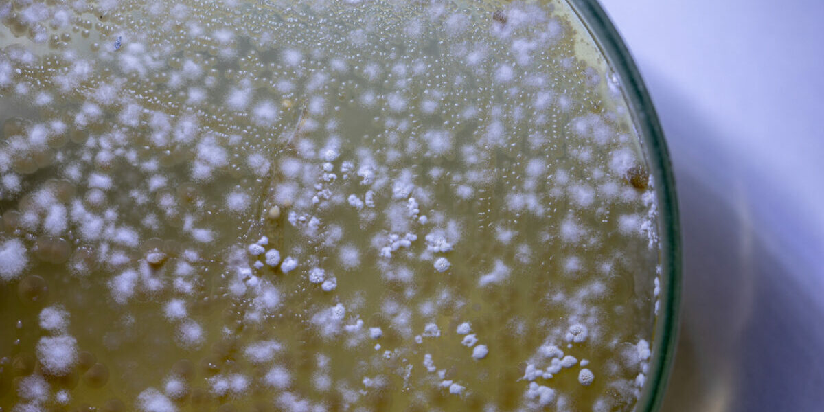 fungal diseases death