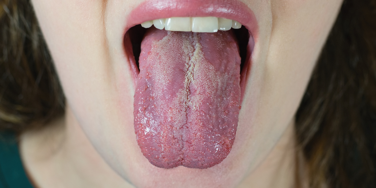Head and neck cancer. (Creative Commons)