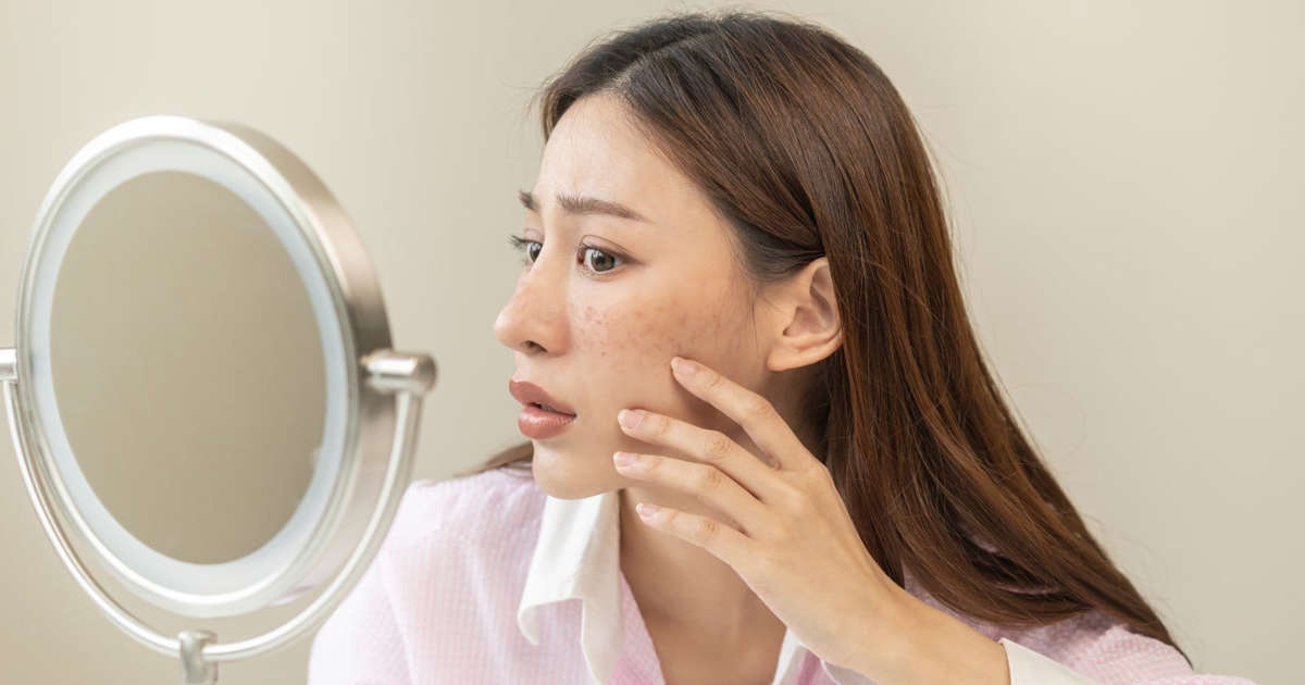 You skin can say a lot about your health. Are you listening to it? (Wikimedia Commons)