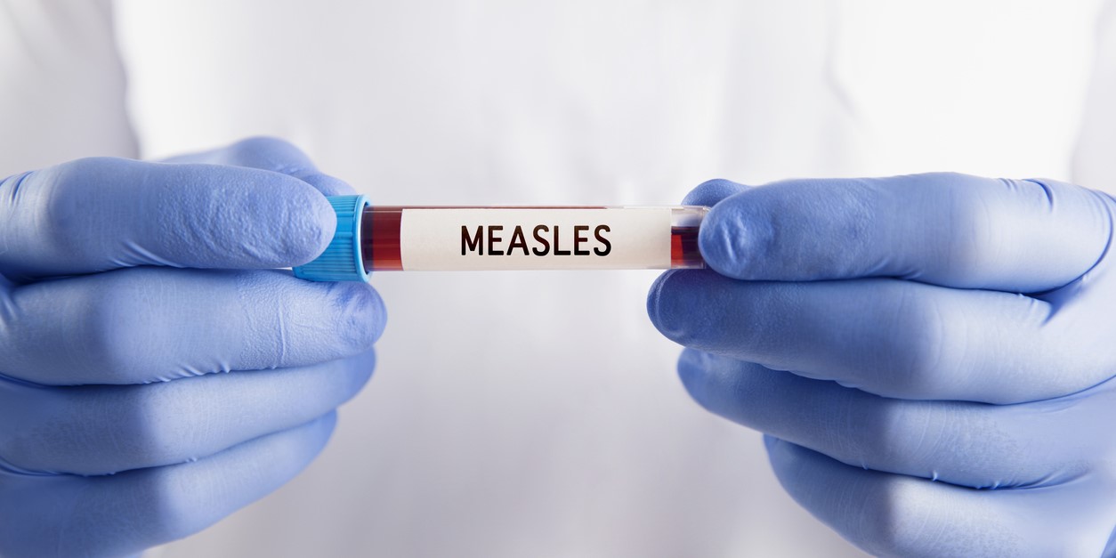 measles award