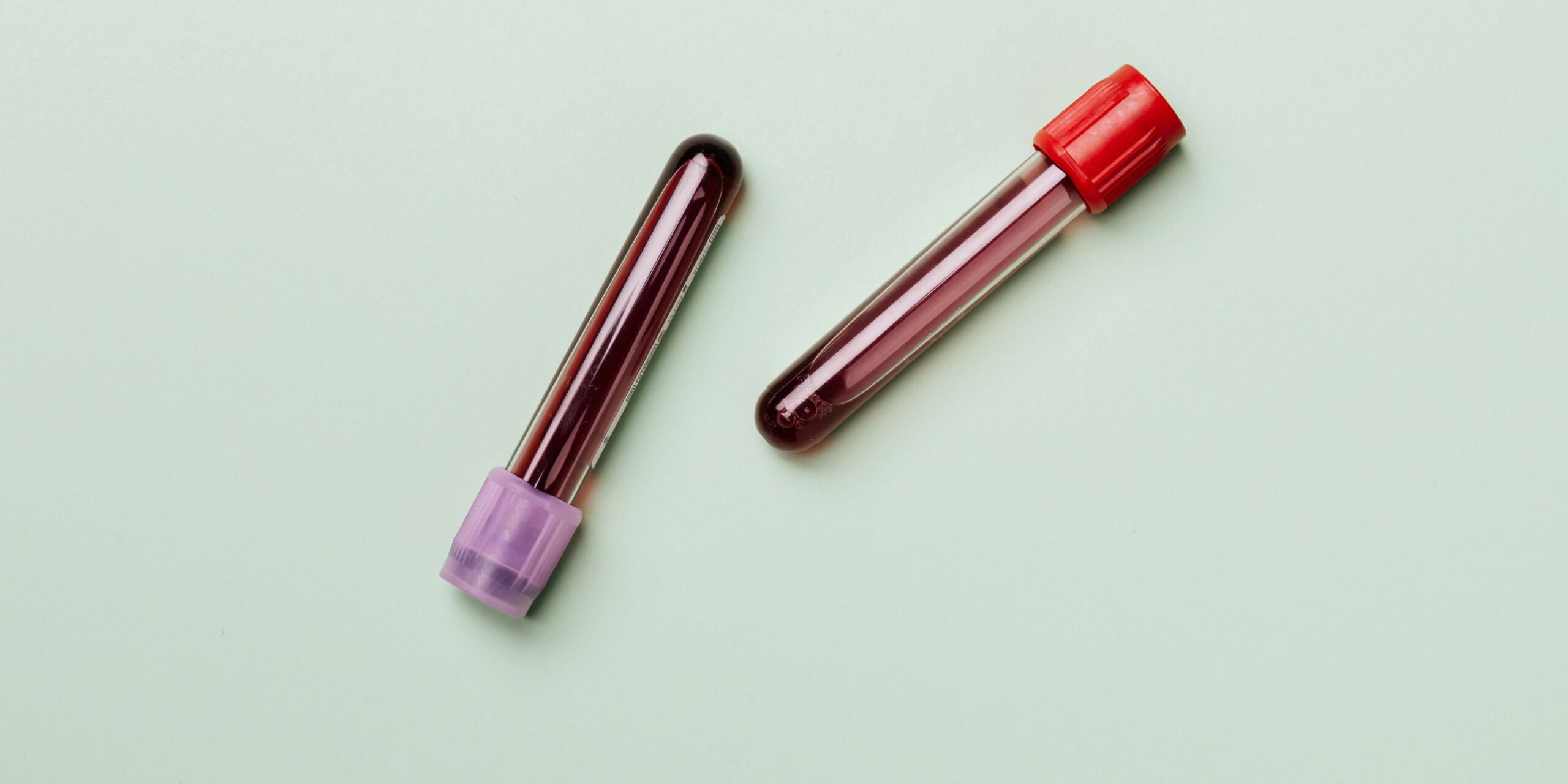 Researchers develop blood test for diagnosing fibromyalgia
