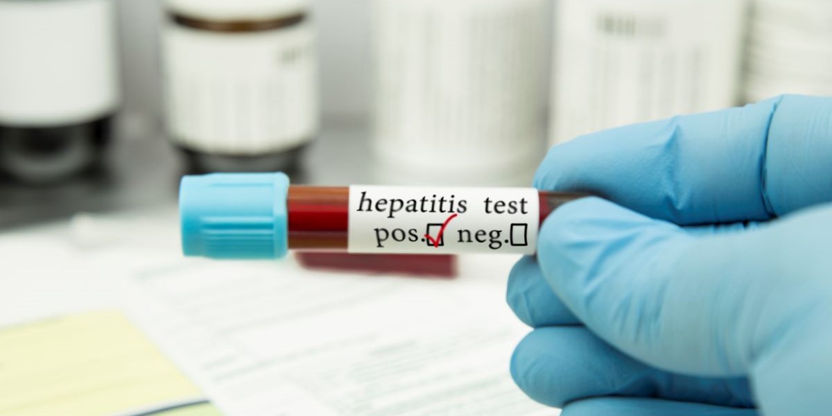 Hepatitis