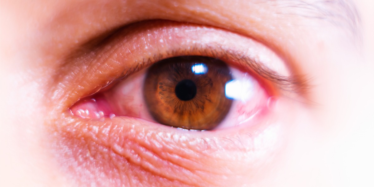 Weight loss drugs linked with increased risk of rare eye-blinding condition