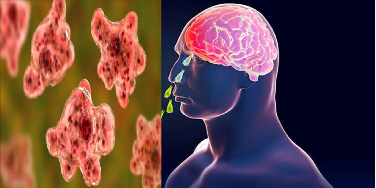 Kerala releases guidelines for managing Amoebic Meningoencephalitis
