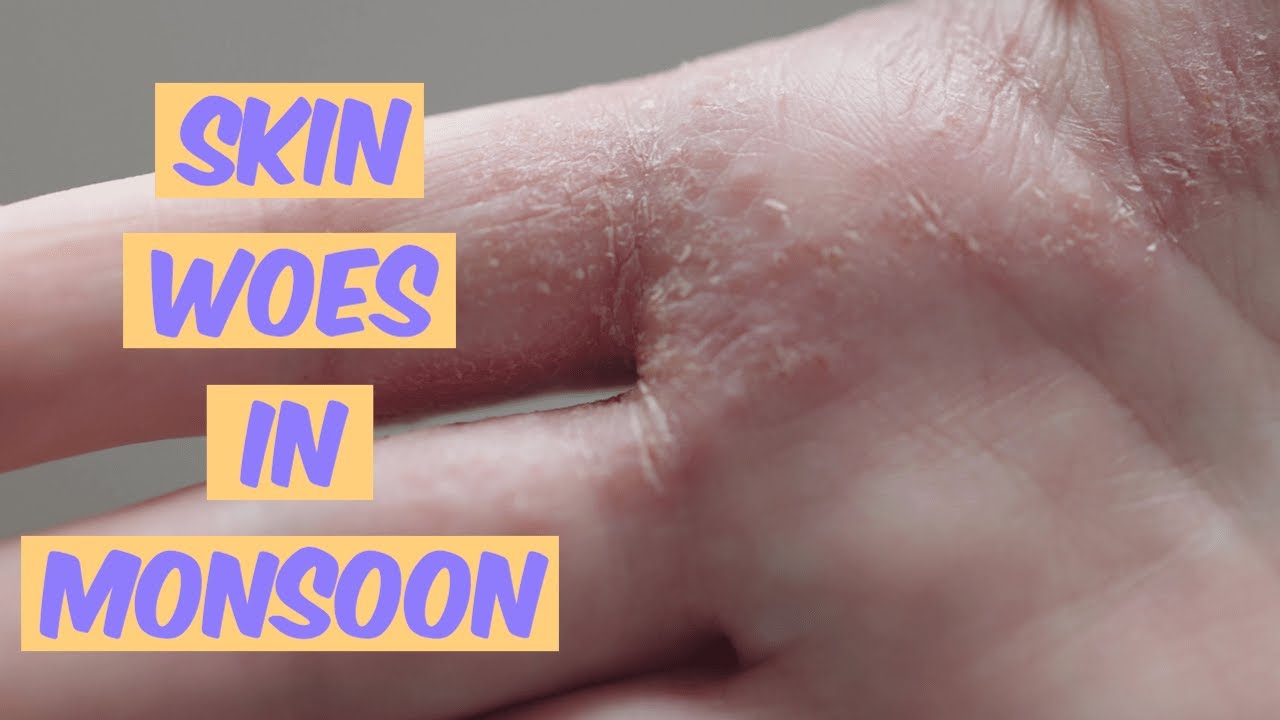 protect skin