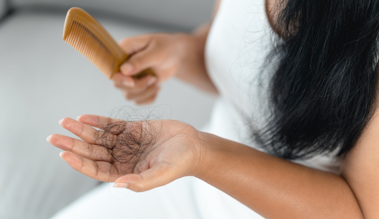 Hair loss