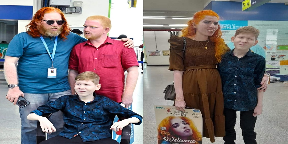 Intercourse with people with albinism to cure AIDS? Kochi Metro chugs in to bust myths