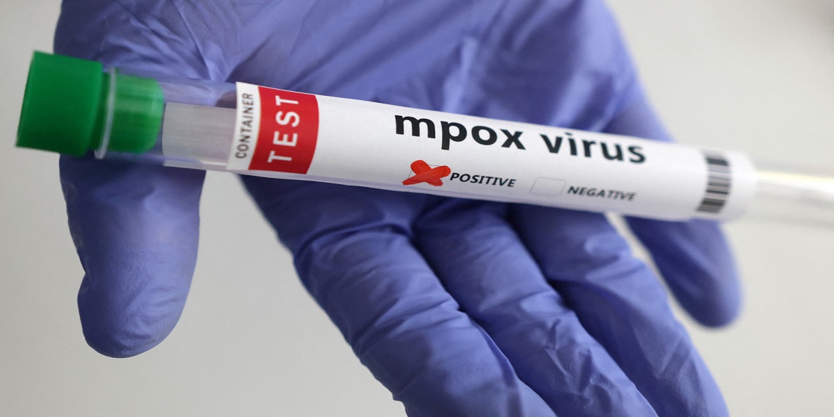 Mpox clade 1b strain detected for the first time in India in Malappuram