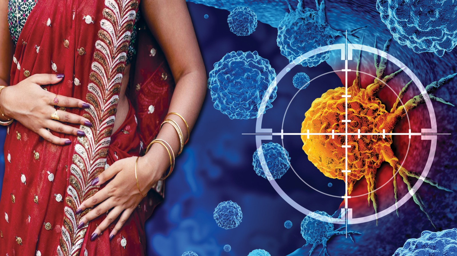 Saree Cancer