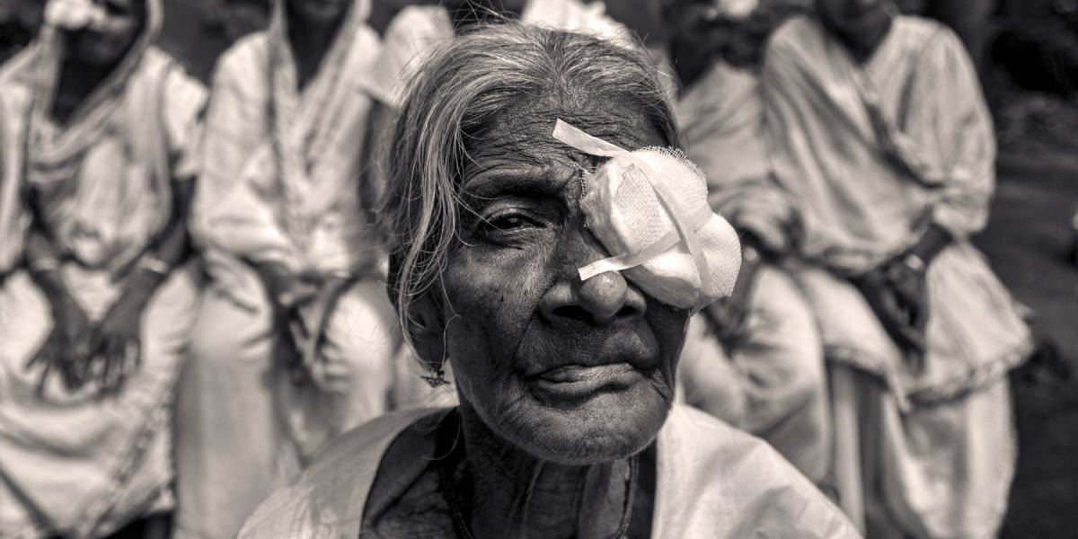 Gender gap in spending on Cataract surgery: Men pick costlier lenses, women don’t