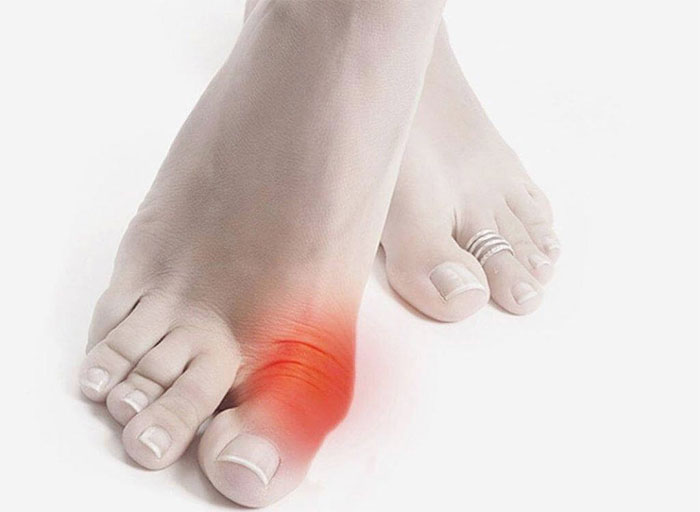 From gout and kidney stones, stroke to heart disease, here’s why elevated uric acid could be putting your health at risk.