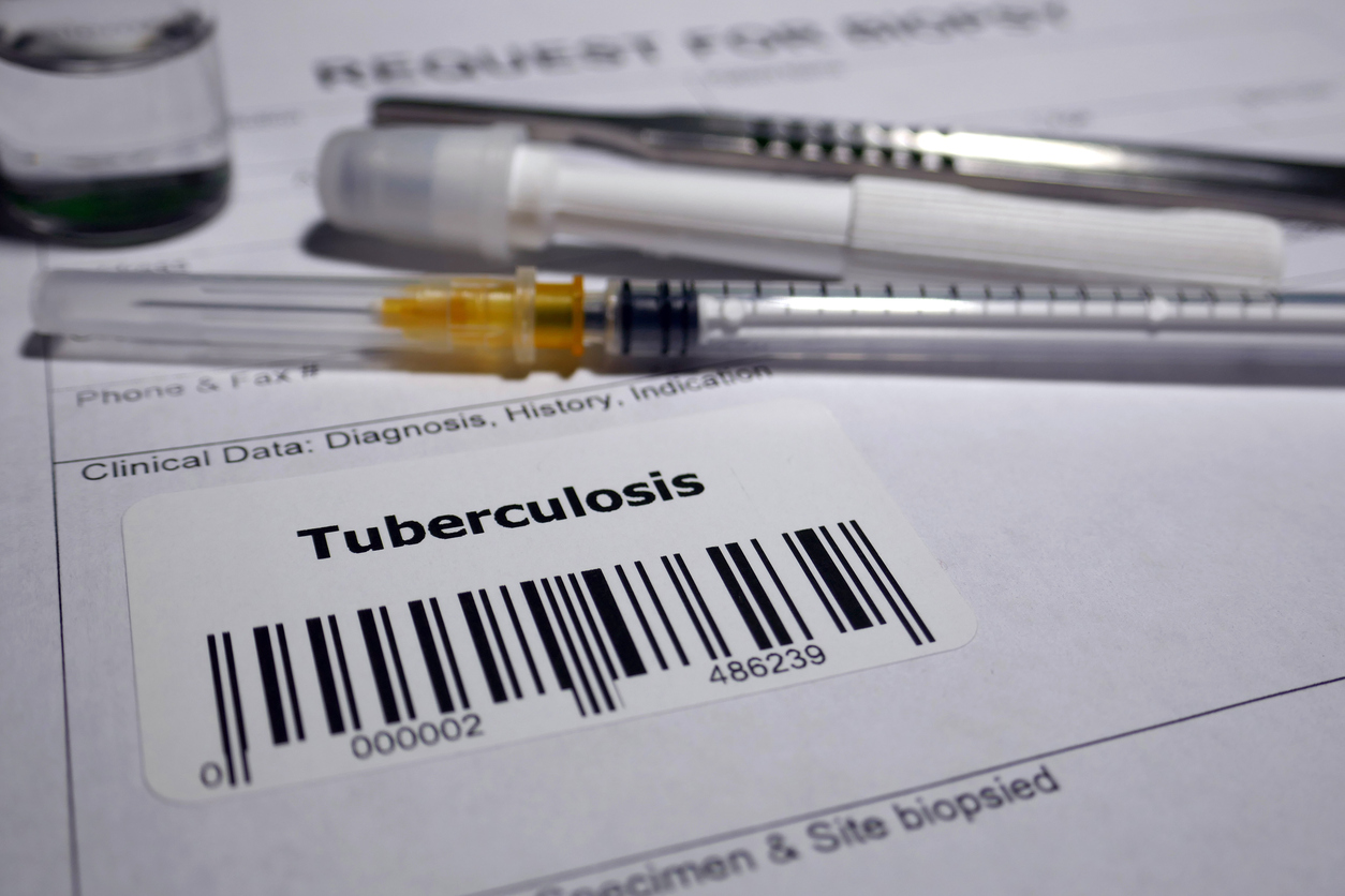 TB care in India