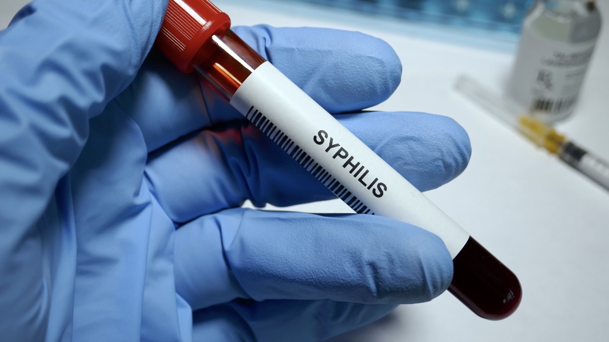 Syphilis is curable, but why does Telangana record one of India’s highest death counts?