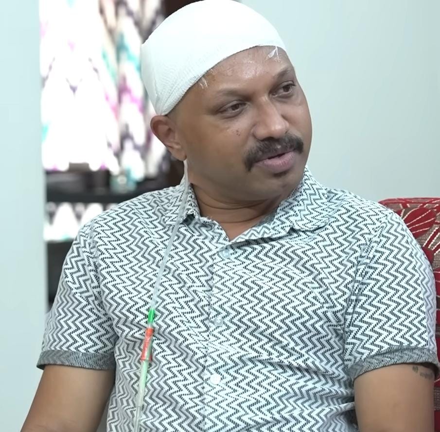 Hair transplant horror: Kerala man battles flesh-eating bacteria following procedure