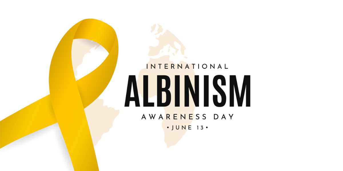 International Albinism Awareness Day.