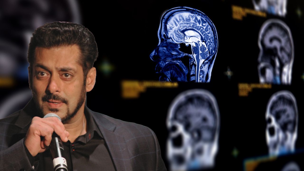 Brain aneurysms: Would most Indians get the same chance at early detection as Salman Khan?