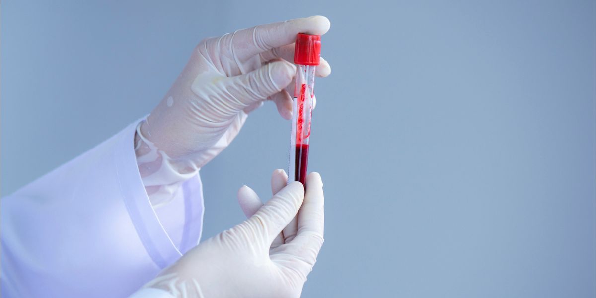 CRIB blood group