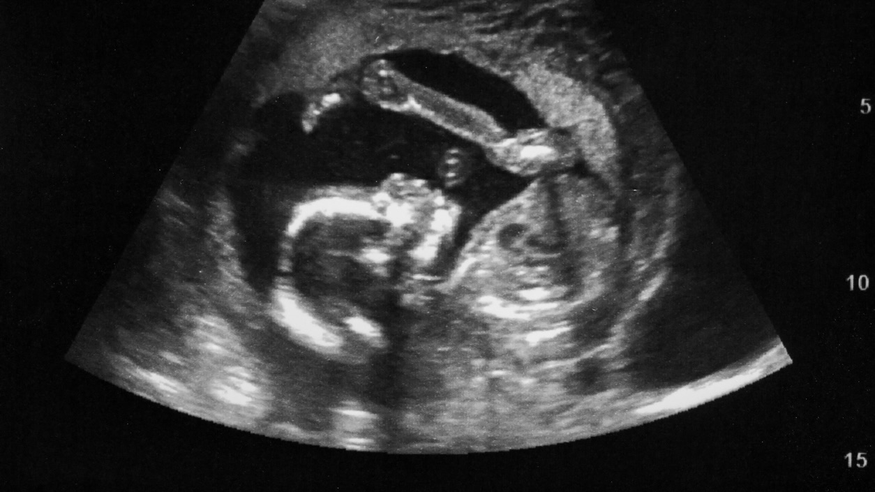 Stillbirths show India’s north–south divide in maternal healthcare, literacy