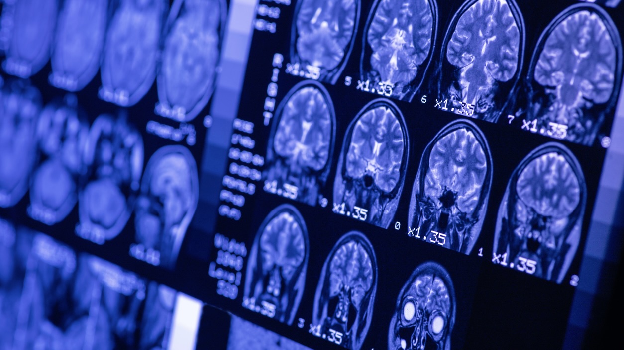 Supreme Court rejects challenge to brain-stem death definition, urges expert review