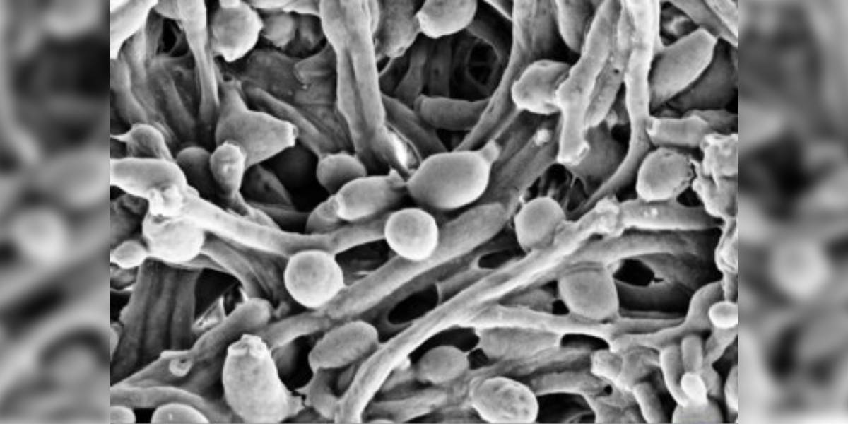 Candida albicans is a yeast that normally exists harmlessly in the human body but can cause invasive infections when the immune system is compromised.