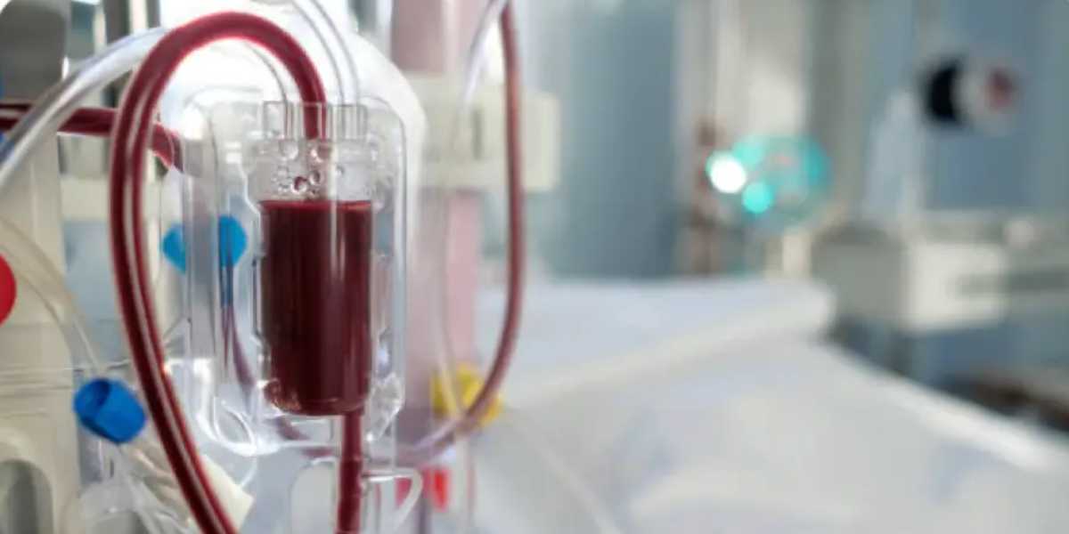 Dialysis. Representational image.