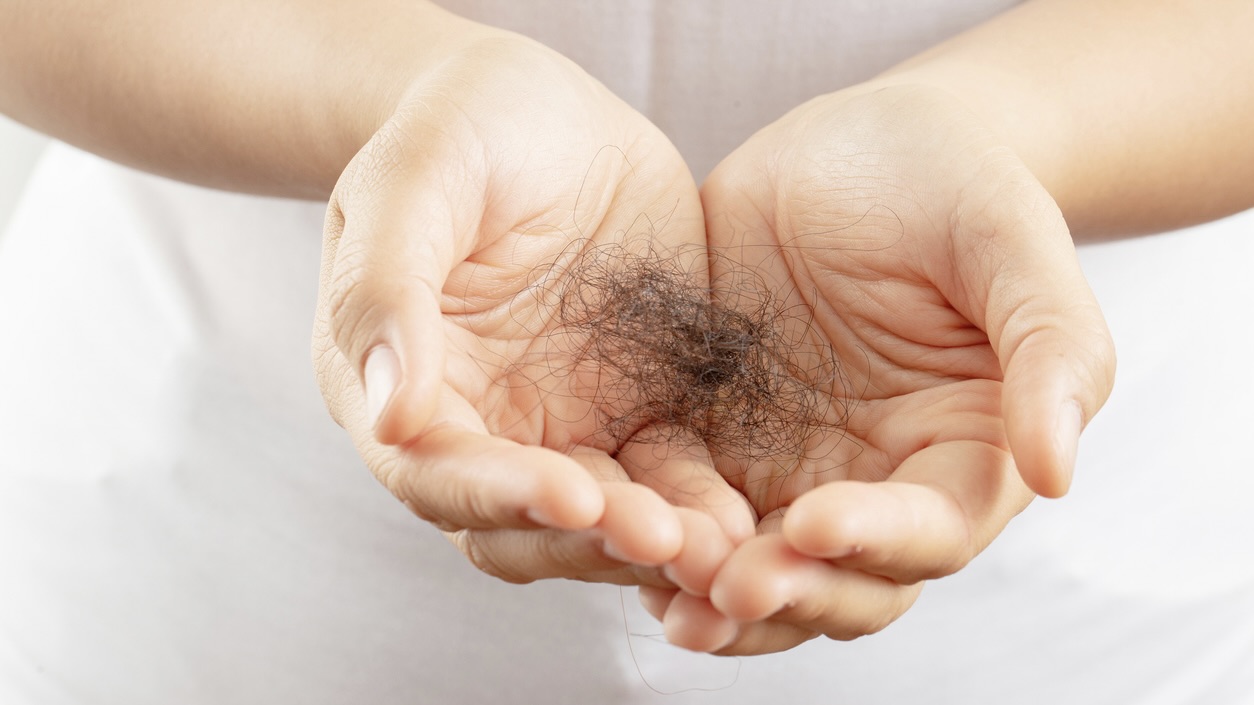 The experts warned that teenage hair loss could soon become a public health concern.