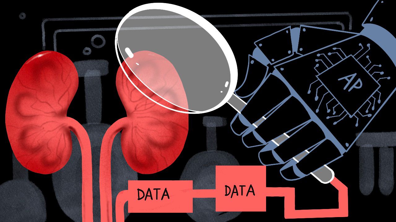 Researchers from the Symbiosis Institute of Technology in Hyderabad and the Aditya Institute of Technology and Management in Tekkali have jointly developed a machine learning system that can predict kidney failure with 98.9 per cent accuracy.